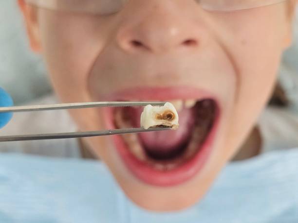 Professional Emergency Dental Service in KS